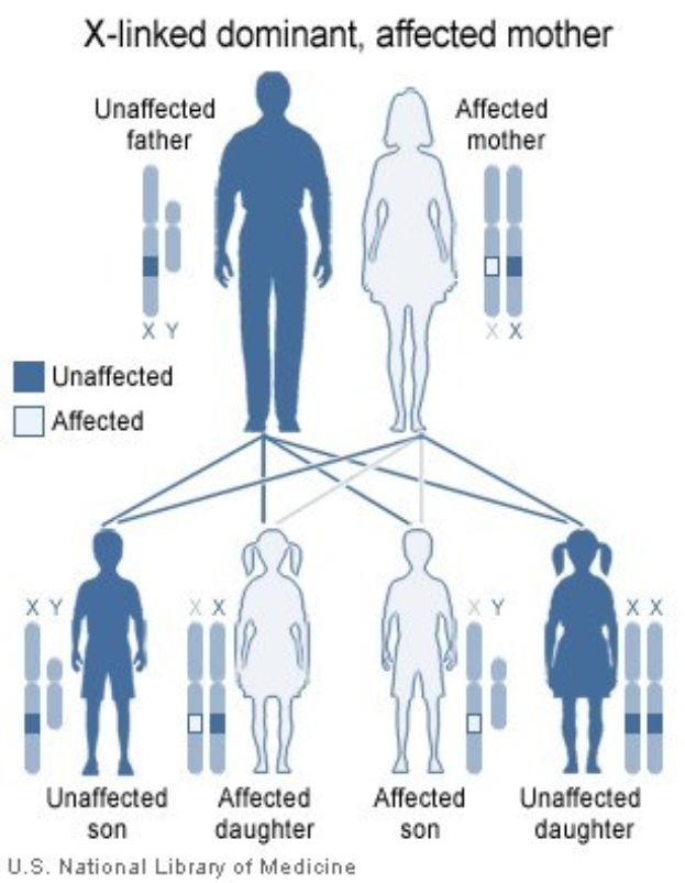 Ein Plakatdiagramm eines X-chromosomal dominanten Familienstammbaums mit einer betroffenen Mutter und begleitendem Text.